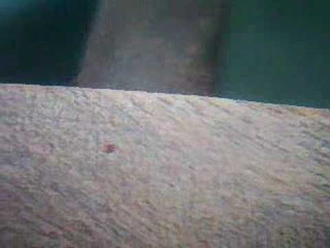 Red Mite