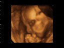 BIANCA VALERIA BENGOA RIOS - 25 SEMANAS