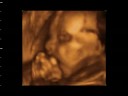 BIANCA VALERIA BENGOA RIOS - 25 SEMANAS
