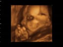 BIANCA VALERIA BENGOA RIOS - 25 SEMANAS