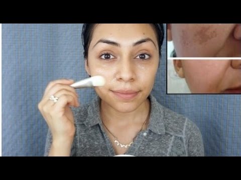 Eliminas las Machas & Marcas de Acne | Mascarilla