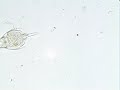 Rotifer,Lepadella costatoides.wmv