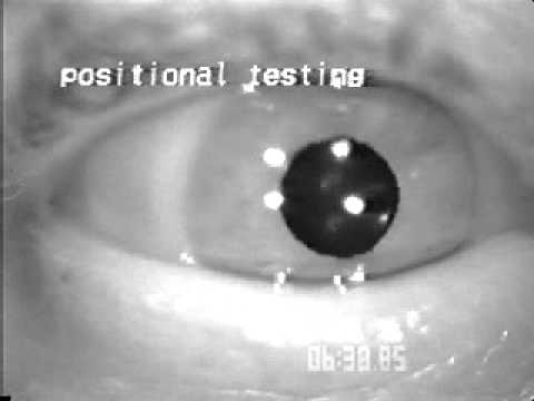how to assess nystagmus