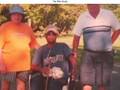 videos de Scleroderma Patient Experiences