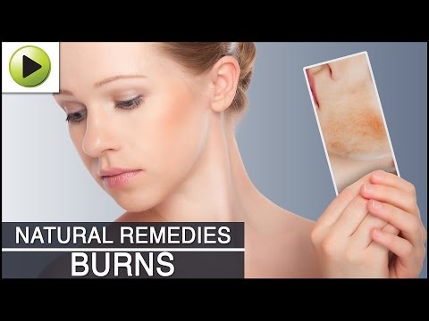 how to relieve first degree burn pain