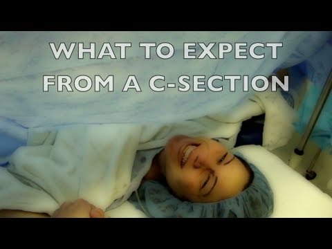 how to recover from emergency c section