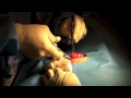 DPT's surgery.. here it is.. *Warning graphics*