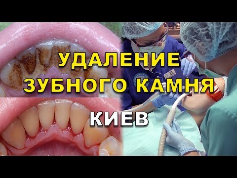 Дубровный Анатолий Викторович. Планета сказок Дизайн на короткие ногти фото и видео новинки