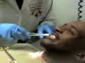 Bubby getting wires off