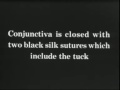 Todd Parker tucking operation (1932), pt 2 of 2