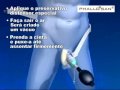 Phallosan - como se usar