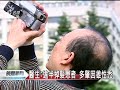Click here to watch this video 20120430-公視晚間新聞-醫生：逾半掉髮患者多為雄性禿.mpg