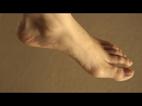 how to cure chilblains