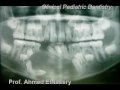 Large Cyst in the Mandible, Pediatric Dentistry