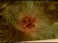 How to Identify Skin Cancer Signs : Signs of Squamous Cell Carcinoma Skin Cancer