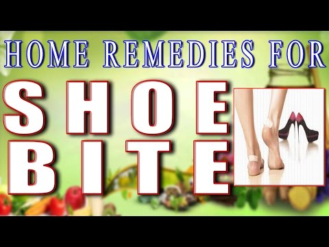 how to cure shoebite