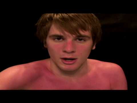 Sunburn Update