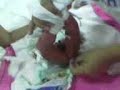 1st hapi pupu 1st hapi pupu