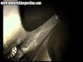 Daniel Senior Orifice Meter Run Inspection using Video Inspection Tools