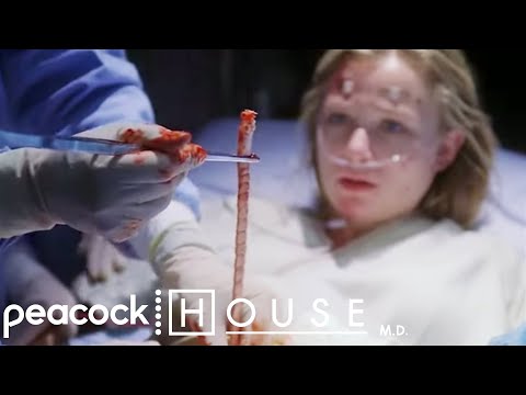 25ft Long Tape Worm | House M.D.