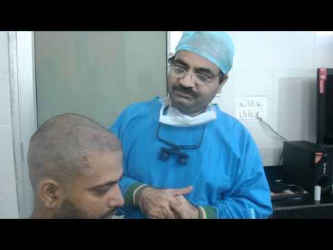 hair transplantation in India - Walia Hair Transplant Center, Ludhiana offer you Hair Transplant procedure at the best affordable and competitive rates.