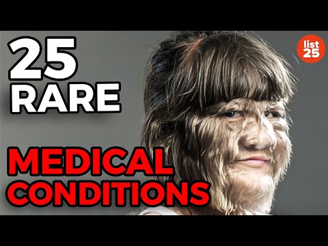 25 Rare Medical Conditions You Never Heard Of