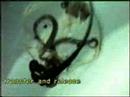 Jellyfish Sex - or rather Pair formation, spermatophore