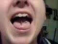 slugs