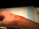 Spooky-Wrist-Pin-Rem