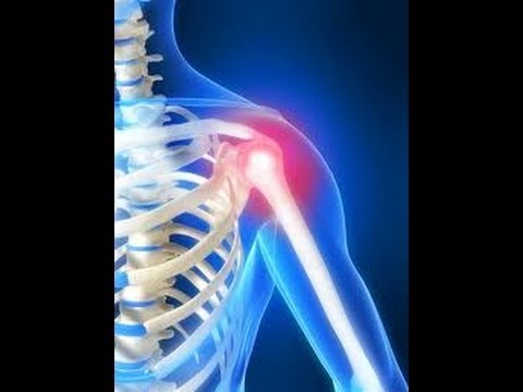 how to relieve pain in shoulder