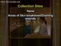 videos de MRSA: How To Swab