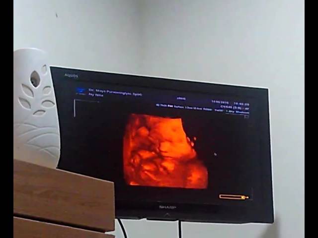 Image Result For Kesehatan Bayi Usia Bulan Image Result For Kesehatan Bayi Usia Bulan