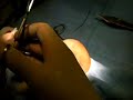 cirugia