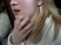 Lingual Frenulum- Holly
