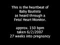 Fetal Heart Monitor