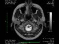 videos de Brain scan MRI
