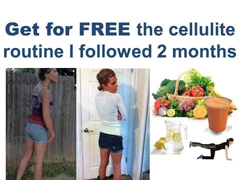 how to get rid of cellulite fast naturally on thighs; best natural anti cellulite removal treatment