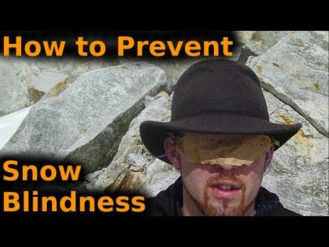 how to treat snow blindness