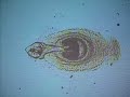 Tapeworm (Hymenolepis diminuta)
