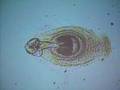 Tapeworm (Hymenolepis diminuta)