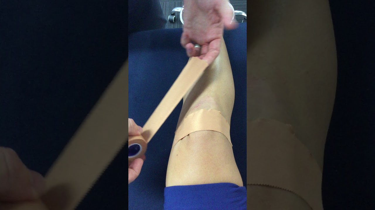 How to tape your knee