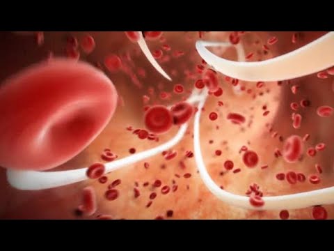 Imagen de previsualización de YouTube