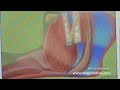 Oral appliance video Oral appliance video
