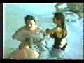 Amputee-Swimmer-2