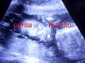 bebe 6 meses gestacion bebe 6 meses gestacion