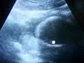 bebe 6 meses gestacion