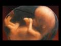 How To Perform A Coathanger Abortion: Bill Nye Lost Episode