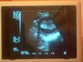 Mi cosita chicaa (l)