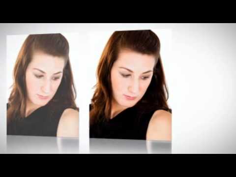 how to treat ice pick scars at home