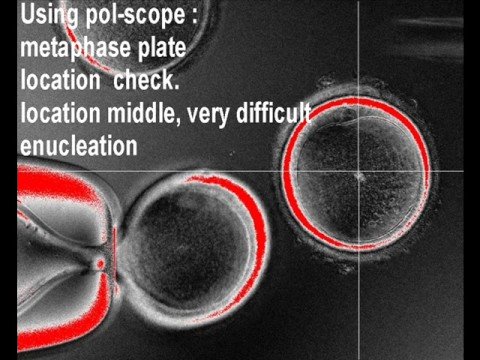 using X-ray slit oocyte  enucleation